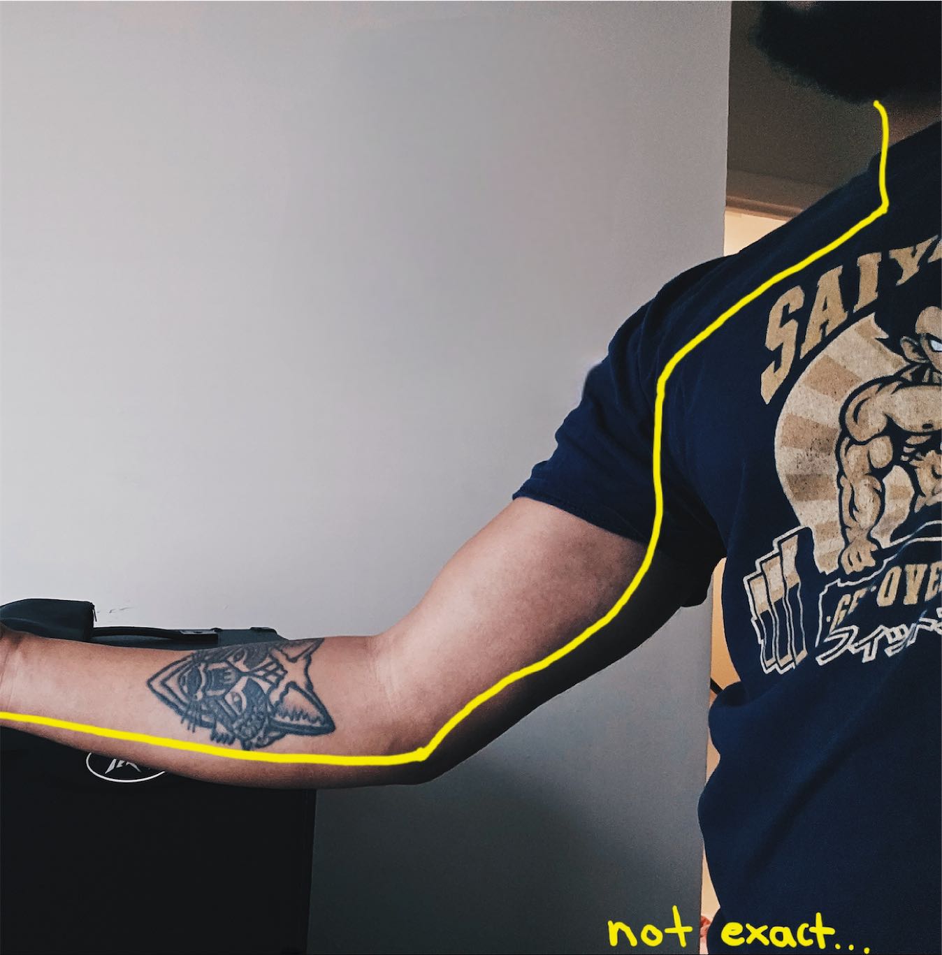 Annotated photo of a close up of my right arm, with another nerve tracing in yellow. It says “not exact…” in the corner to imply the tracing is not exactly path of the nerve